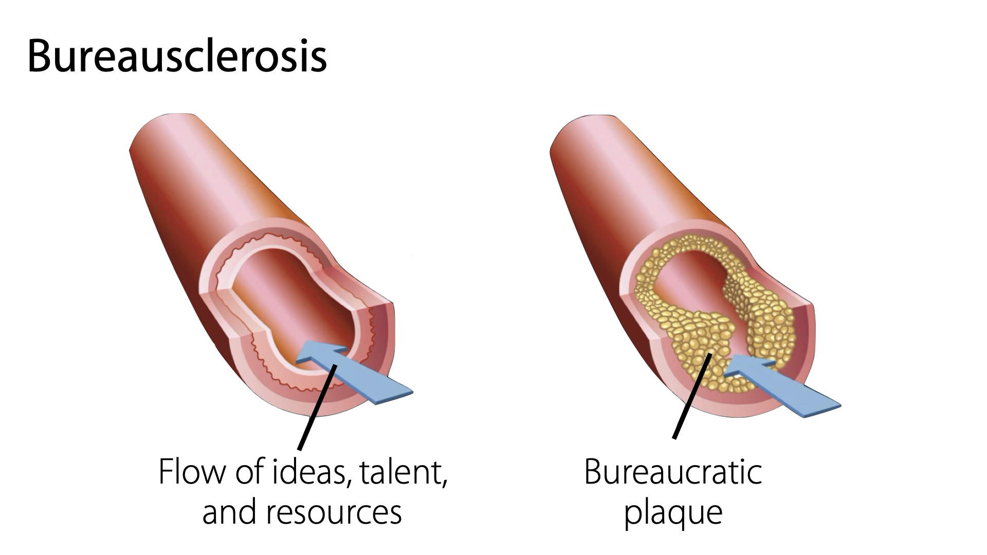 A Radical Cure for Bureausclerosis